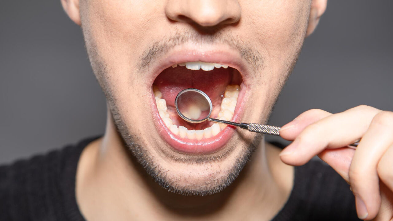 Dlaczego tak ważna jest kontrola jamy ustnej?